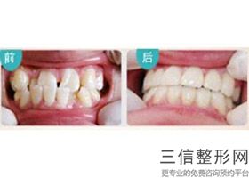 北京口腔科医院排名前十名单,口腔科 北京排名