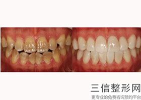 北京口腔医院排名榜前五整牙甄选,北京十大较好口腔医院