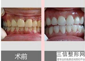 北京口腔医院排名榜前五整牙甄选,北京十大较好口腔医院