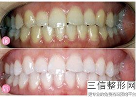 北京口腔医院排名榜前五整牙甄选,北京十大较好口腔医院