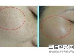 北京拉皮手术专家排名榜前十权威推荐,全国做拉皮手术的权威专家