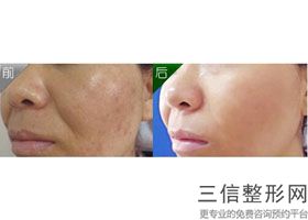 北京拉皮手术专家排名榜前十新版上线,北京拉皮手术哪家医院好