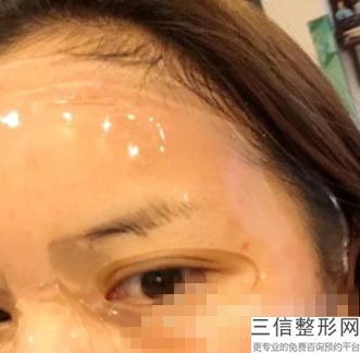 北京拉皮手术专家排名榜前十新版上线,北京拉皮手术哪家医院好