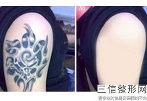 北京拉皮手术专家排名榜前十新版上线,北京拉皮手术哪家医院好