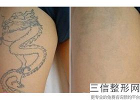 北京拉皮手术专家排名前十综合,拉皮手术医生排名