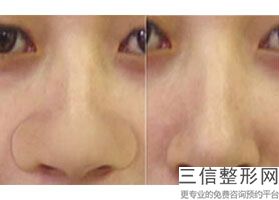 北京隆鼻排名前十的整形医院名单发布,北京鼻子整形医院排名
