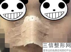 北京隆鼻排名前十的整形医院名单发布,北京鼻子整形医院排名