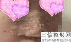 北京隆鼻排名前十的整形医院名单发布,北京鼻子整形医院排名