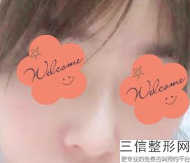 北京隆鼻三甲公立医院排行榜名单介绍,北京整鼻子三甲医院