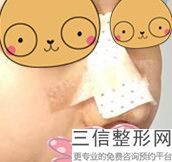 北京隆鼻三甲医院排行榜公立名次更新,北京隆鼻医生排名