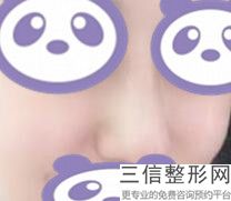 北京隆鼻十大专家名单发布,北京医院隆鼻