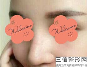 北京隆鼻十大专家名单发布,北京医院隆鼻