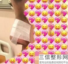 北京隆鼻医生排名榜前十,北京隆鼻比较好的医生