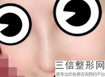 北京隆鼻医生前十排名榜,北京鼻子整容排名前十