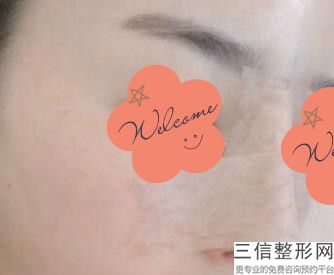 北京隆鼻医院排行榜四大权威医美揭晓,隆鼻北京哪家医院好呀