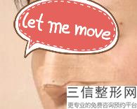 北京隆鼻医院排行榜四大权威医美揭晓,隆鼻北京哪家医院好呀