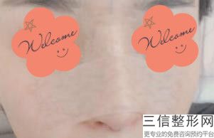 北京隆鼻医院排名前十抢先预览,北京隆鼻哪个医院好
