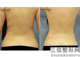 北京隆胸三甲医院排名前十权威盘点,北京丰胸医院排名前十