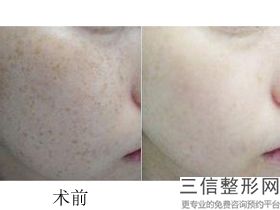 北京明会红医疗美容诊所口碑,北京明德医院美容皮肤科正规吗