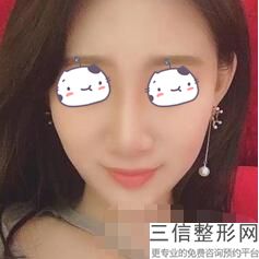 北京哪家私立医院隆鼻好,北京隆鼻三甲公立医院