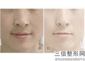 北京热玛吉官方认证医院提前预览,热玛吉官方认证医生查询