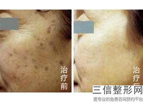 北京热玛吉官方授权医院查询,怎么查热玛吉官方授权医院