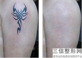 北京热玛吉官方授权医院查询,怎么查热玛吉官方授权医院