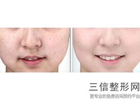 北京热玛吉官方授权医院哪家好,北京热玛吉官方授权医院查询