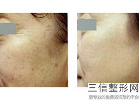 北京热玛吉官方授权医院这里查询一二,北京热玛吉正规医院