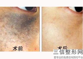 北京热玛吉认证医院排行榜前五名单查看,热玛吉认证医生和认证医院