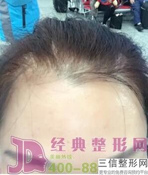 北京热玛吉认证医院排行榜前五名单查看,热玛吉认证医生和认证医院