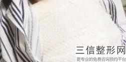 北京乳房整形医院排名六大知名机构汇总,胸部整形医院排名