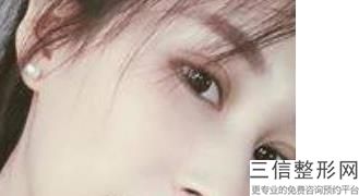 北京双眼皮修复专家排名榜top10权威更新,北京双眼皮修复专家名单