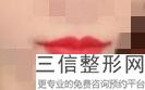 北京兔唇微整形医院排行榜前六推荐,国内兔唇整形医院排名
