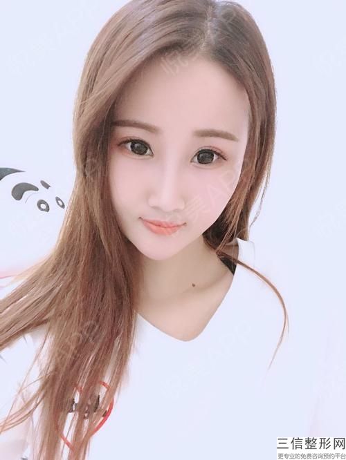 北京吸脂医生前十名榜单权威发布,北京做面部吸脂比较有名的医院