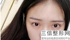 北京眼部综合整形医院排名榜六强更新,眼部整形医院排名前十