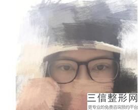 北京眼部综合整形医院排名榜六强更新,眼部整形医院排名前十