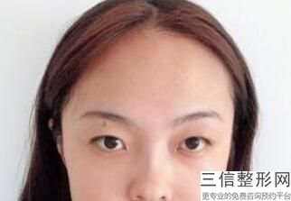 北京眼整形修复医院排名前十揭晓名单,北京眼部整形良好的医院