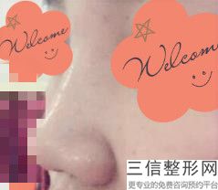 北京整容三甲医院排名隆鼻类公立医美汇总,北京排前五的整容医院