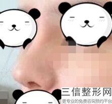 北京整形美容隆鼻医院排名前八权威盘点,北京隆鼻哪个医院好