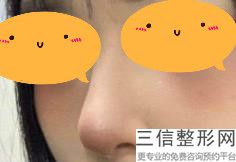 北京整形美容隆鼻医院排名前八权威盘点,北京隆鼻哪个医院好