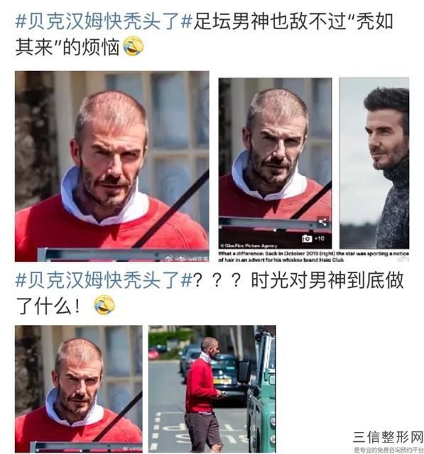 北京植发三甲医院排名榜前五强公测,北京权威植发医院排名