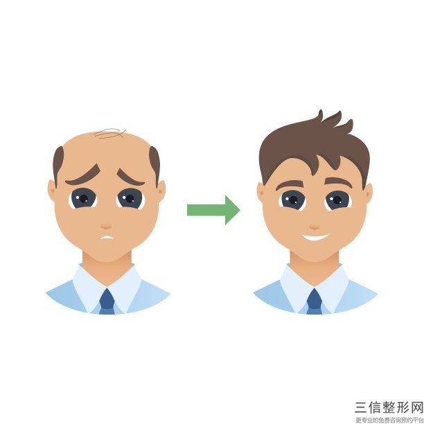 北京植发医院哪家医技术好,北京植发哪家医院比较好