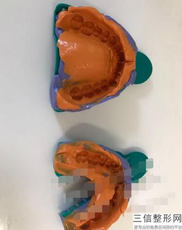 北京种植牙三甲医院排名榜top5权威总评,北京哪家医院种植牙良好