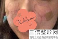 北京嘴部整形医院排名前六权威点评,嘴巴整形医院