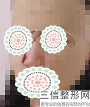 北京嘴部整形医院排名前六权威点评,嘴巴整形医院