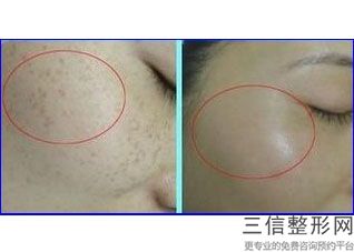 北京做拉皮整形医院排名前五权威榜单公布,拉皮手术医院和整形院哪里好