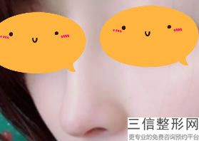北京做隆鼻有名的医生推荐,北京做隆鼻良好的医生