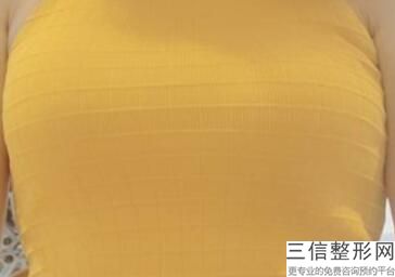 北京做隆胸美容整形医院排行榜前十强,隆胸哪家整形医院好