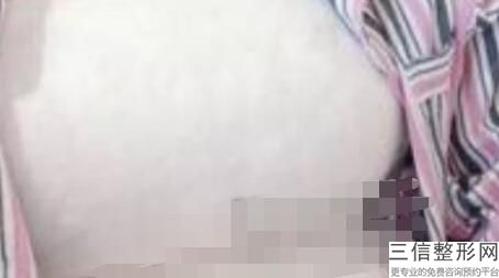 北京做隆胸美容整形医院排行榜前十强,隆胸哪家整形医院好